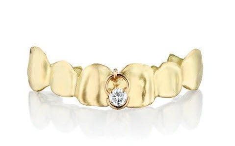 Achieve That Perfect Custom Gold Grillz Fit with Professional Dental Molds!