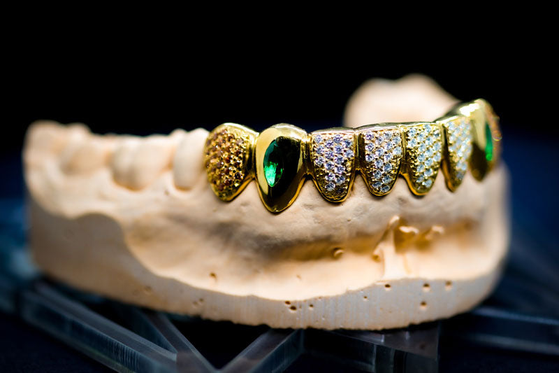 5 Ways to Clean Your Custom Gold Grillz