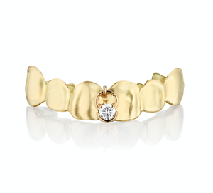 bespoke gold teeth design deposit